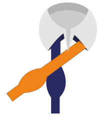 bow-tie